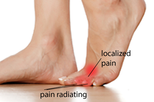 dolore piedi
